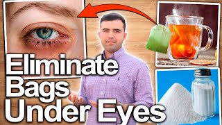 How to Eliminate Bags Under Your Eyes - No More Puffy Eyes and Eye Bags