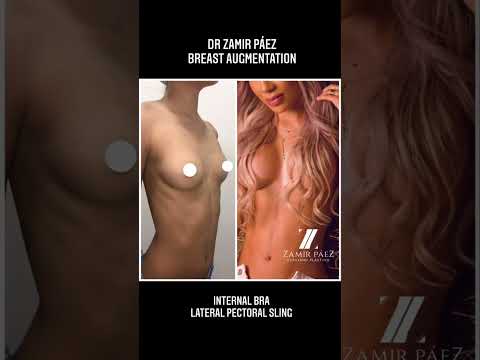 Zamir Páez-201