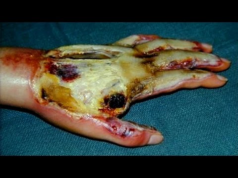 Dünyanın En Tehlikeli 10 Kimyasal Maddesi