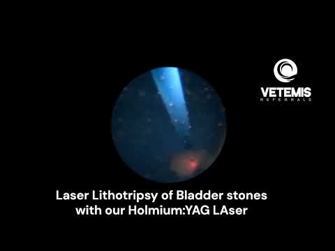 Holmium YAG Laser Lithotripsy of Bladder Stones