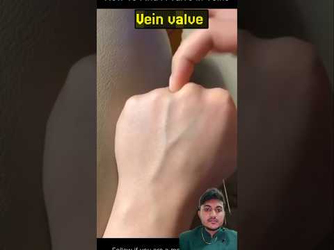Vein valve #vainvalve #bloodvessels #valve
