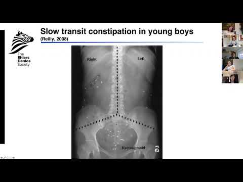EDS ECHO Clinicians UK/Europe (CLN3B), Session 4