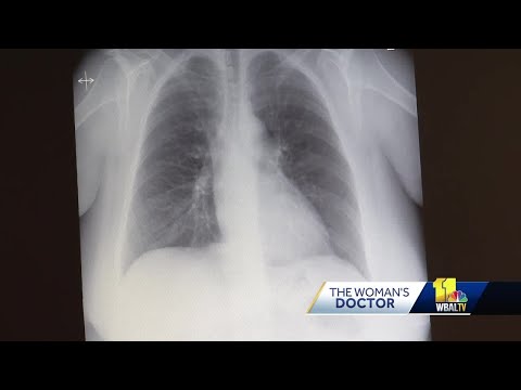 Doctor explains difference between acute, chronic bronchitis