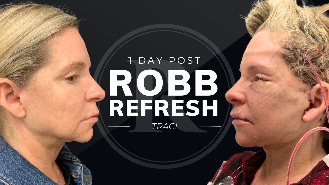 Robb Facial Plastic Surgery