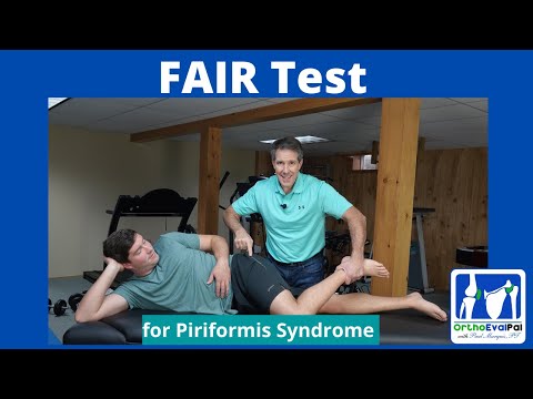 FAIR Test for Piriformis Syndrome