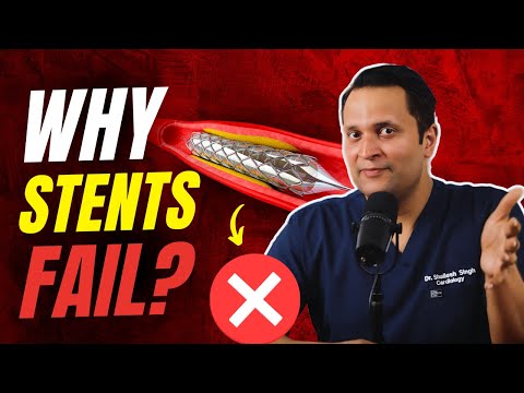 Why Heart Stents Fail