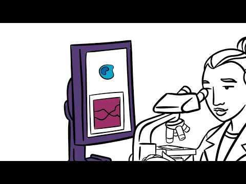 Cancer Basics – What do cancer stage and cancer grade mean?