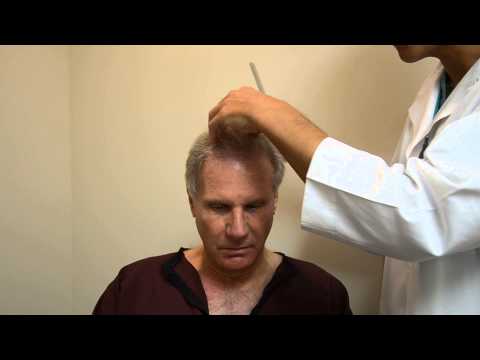 Dr. Jeffrey Epstein - Hair Transplant