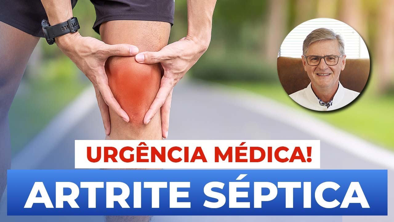 Artrite séptica (Sintomas, Diagnósticos e Tratamentos)