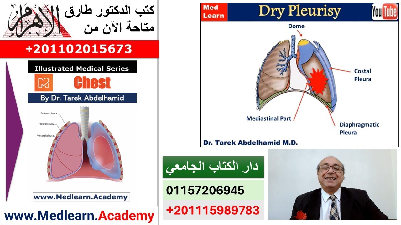Dry Pleurisy    #cme #internal_medicine #medical #usmle #محاضرات_باطنة