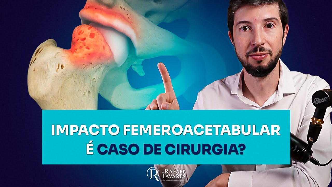Impacto Femoroacetabular é caso de cirurgia? | Dr Rafael Tavares - Quadril