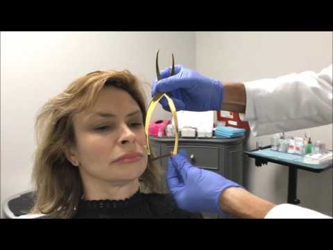 Facial Proportions with Golden Ratio Measurements