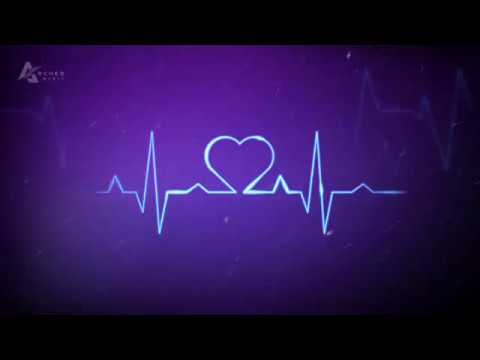 ELLA - Передоз любви!