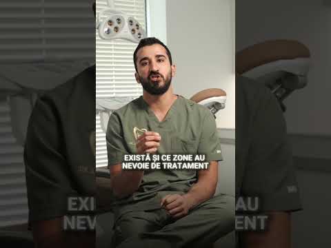 Adevărul despre prețurile implanturilor dentare – de ce ai nevoie de CT
