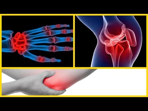 Geschwollene und schmerzende Knie Amtsenthebungsverfahren Knöchels Syndrom