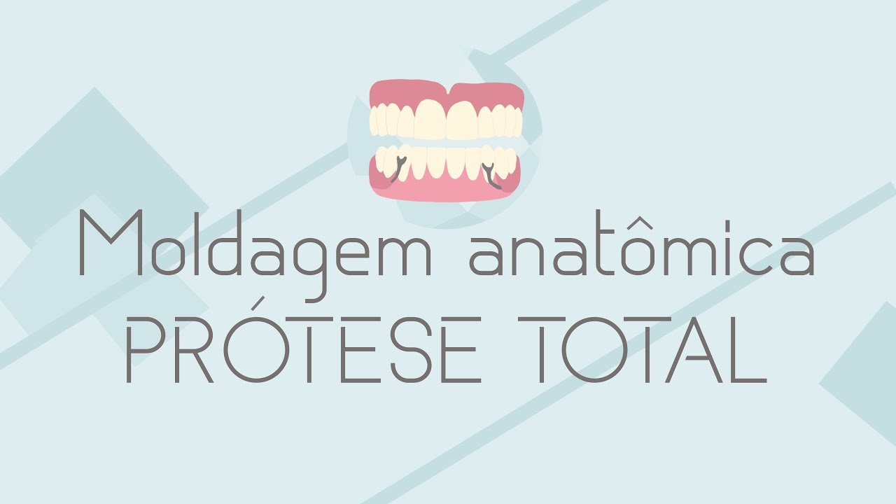 SEQUÊNCIA CLÍNICA Moldagem anatômica de PT com alginato