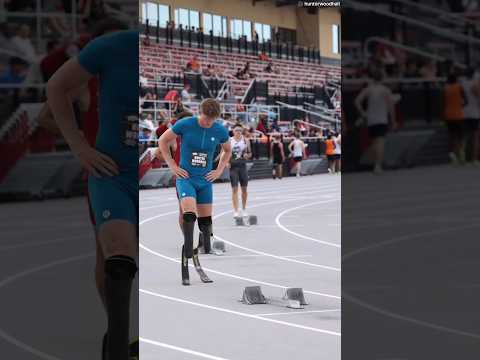 Everyone Laughed at His Metal Legs 😱#shortvideo #viralvideo