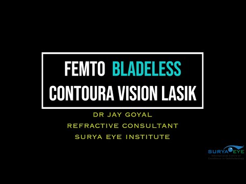 Femto Bladeless Contoura Vision LASIK