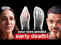 The Foot Expert: Your Toes Can Predict If You’ll Die Early! This Will Fix Plantar Fasciitis!