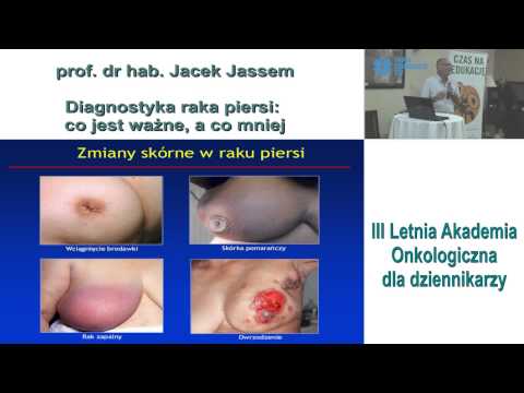 Masaż stóp z palucha koślawego Gatunki deformacja stóp