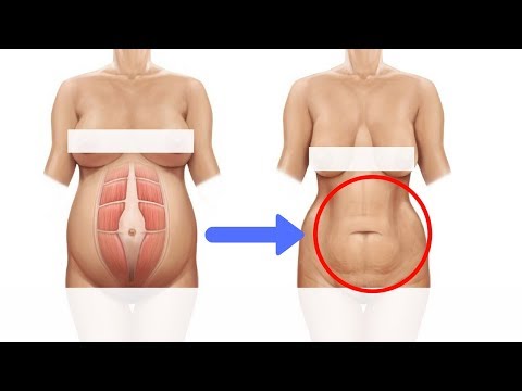 Manok na sopas recipe para sa slimming Turboslim lahat ng mga bawal na gamot bumili