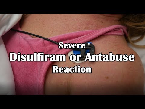 YouTube video about: Where can I buy antabuse tablets?