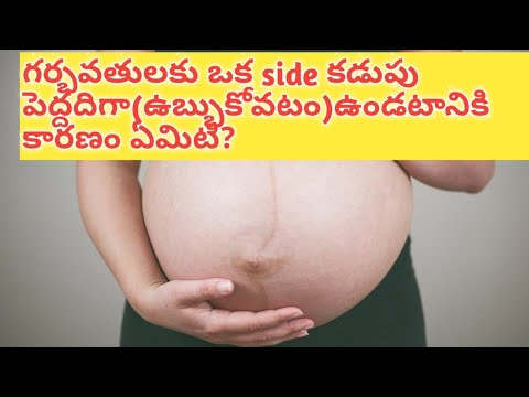 గర్భవతులకు ఒక side కడుపు ఉబ్బుకోవటానికి కారణాలేమిటి?why pregnant belly is slightly bigger in one sid