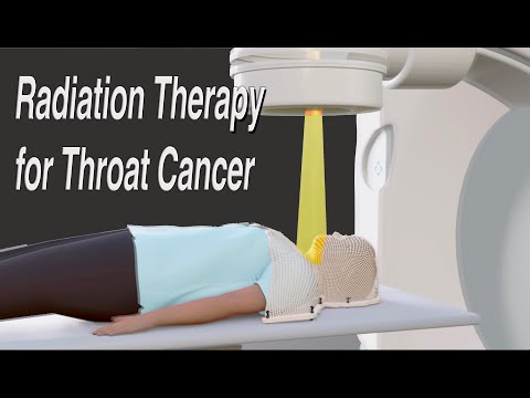 Throat Cancer Radiation Therapy - Long Version