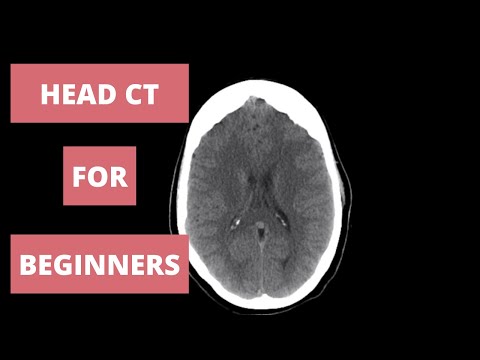 How to Read a Head CT - Radiology Approach