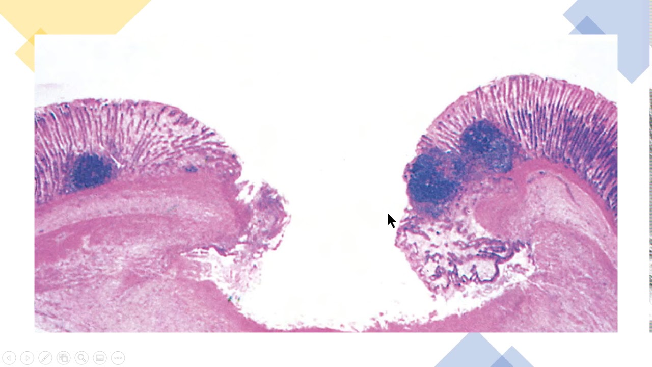 Inflamação Prostaglandinas