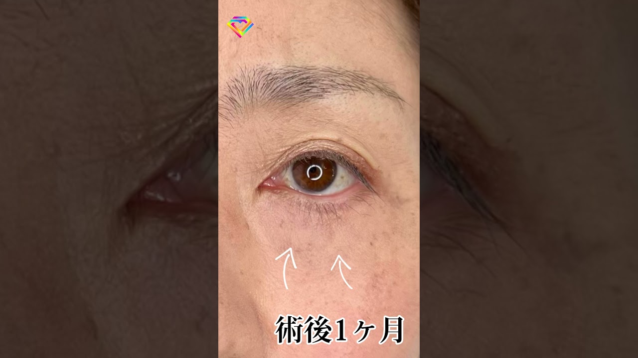 Youtubeのサムネイル