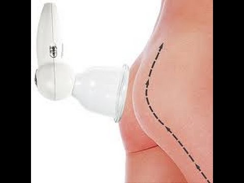 Teralidzhen con osteocondrosi cervicale Quali vitamine in osteocondrosi vertebrale