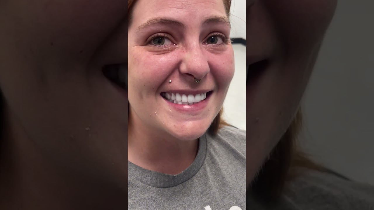 Ashley | Affordable Dentures & Implants Moments