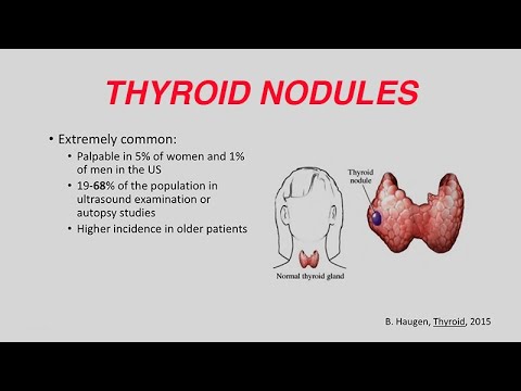 Thyroid Nodules - Cancer Risk Factors and Radiation Exposure (Chernobyl, Fukushima) - YouTube