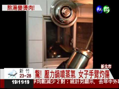 壓力鍋噴蒸氣 女子手臂3度灼傷