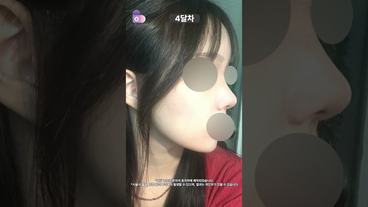 '코' 하나로 인스타 무드 ON!