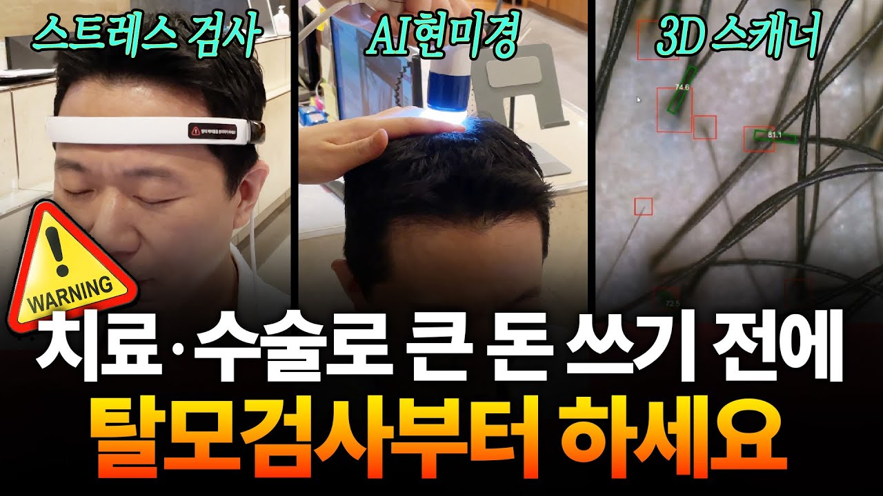  치료, 수술 케이스가 아닐 수 있다? 탈모 검사로 확인하기