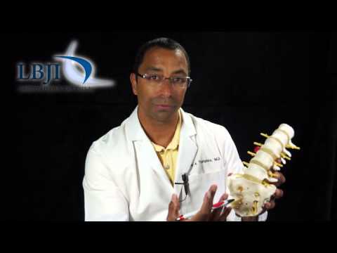 Dr. Anton Thompkins Explains Lumbar Fusion