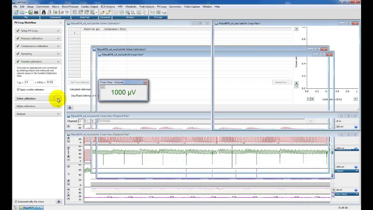 Analysing Pressure-volume (PV) loops using ADInstruments LabChart Pro