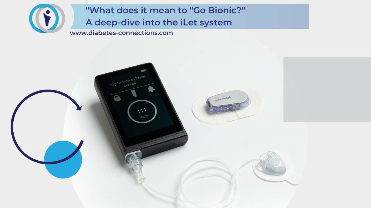What does it mean to "Go Bionic?" - A deep dive into the newly-approved iLet system