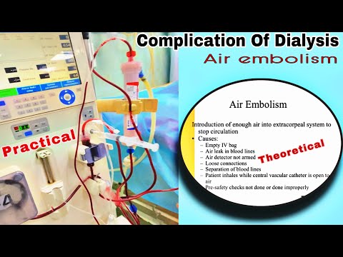 Complication During Dialysis | Air Embolism