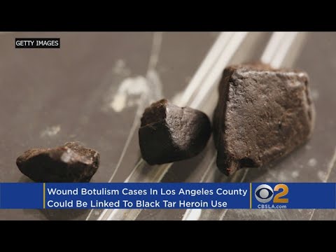 Several Botulism Cases In LA Possibly Linked To Black Tar Heroin Use