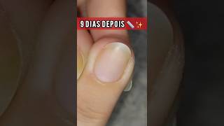 Crescimento Real: 9 dias 📏✨😱 usando essa base de baratinha. Chocada com o resultado!!💅🏻😲💕