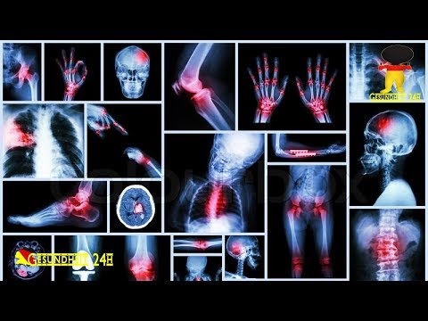 Wund Schultergelenk Osteochondrose Schmerzen im unteren Rücken rechten Seite aufgibt
