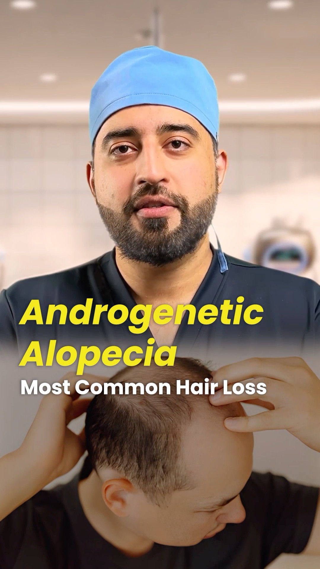 Types of Hair Loss and treatment