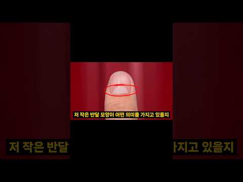 손톱에 이 것이 있다면 꼭 보세요!!