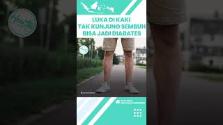 Waspadai Luka di Kaki Tak Kunjungi Sumbuh hingga Bernanah Bisa Jadi Tanda Penyakit Diabetes