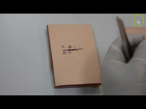 Dentiscope | The Figure of Eight Suture Technique