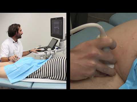 Groin pain and ultrasound - part 7 - Posterior aspect of the hip and hamstrings tendons