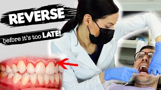 How To Treat Gum Disease